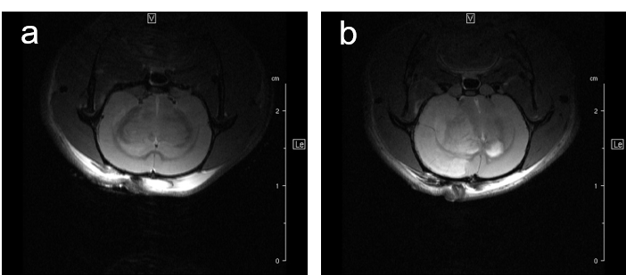 Fig. 7: Infarcted rat brain MRI. For comparison of infarct size of induced infarct right after OP and 24 h later a T2 weighted Spinecho sequence was used:  repetition time: 3800 ms, echo time: 18.0 ms, field of view: 35x35  mm2, matrix:512x256  and slice thickness 1.0 mm was used to acquire 12 axial slices. Fig. 7: Infarcted rat brain MRI. For comparison of infarct size of induced infarct right after OP and 24 h later a T2 weighted Spinecho sequence was used:  repetition time: 3800 ms, echo time: 18.0 ms, field of view: 35x35  mm2, matrix:512x256  and slice thickness 1.0 mm was used to acquire 12 axial slices.