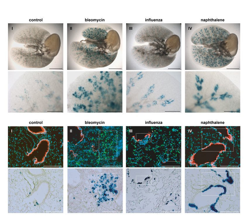 BASCs contribute substantially to distal lung regeneration and display a bi-potent differentiation potential. Top: β‐galactosidase staining of cleared whole lung preparations isolated from control and injured BASC-specific animals (SPC-2A YFP-2A tTA N, CCSP-2A mCherry-2A tTA C, tetObiluc/Cre, Rosa26stopflox-lacZ) 21 days (bleomycin, naphthalene) or 35 days (influenza) following injury. Bottom: Sequential imaging of epifluorescence and β‐galactosidase activity, illustrating the alveolar and bronchiolar fate of BASC-derived cells. BASCs contribute substantially to distal lung regeneration and display a bi-potent differentiation potential. Top: β‐galactosidase staining of cleared whole lung preparations isolated from control and injured BASC-specific animals (SPC-2A YFP-2A tTA N, CCSP-2A mCherry-2A tTA C, tetObiluc/Cre, Rosa26stopflox-lacZ) 21 days (bleomycin, naphthalene) or 35 days (influenza) following injury. Bottom: Sequential imaging of epifluorescence and β‐galactosidase activity, illustrating the alveolar and bronchiolar fate of BASC-derived cells.