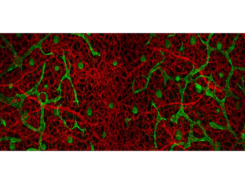 Nicht alle Gefäße sind gleich. Die Fluoreszenzaufnahme zeigt Blutgefäße (rot) und Lymphgefäße (grün). Während der Entwicklung entspringen diese aus unterschiedlichen Arealen des Embryos. Nicht alle Gefäße sind gleich. Die Fluoreszenzaufnahme zeigt Blutgefäße (rot) und Lymphgefäße (grün). Während der Entwicklung entspringen diese aus unterschiedlichen Arealen des Embryos.