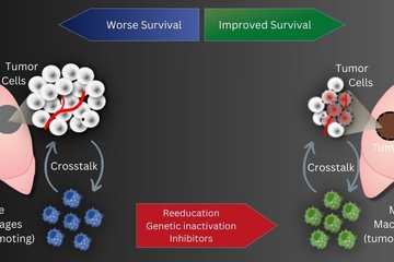 <p><strong>Therapeutic key for lung cancer discovered</strong></p>