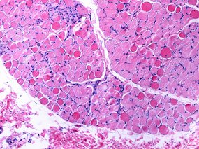 Mechanismus zur Behandlung von Muskelschwund entdeckt