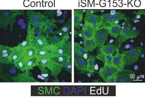 Glatte Muskelzellen unterm Fluoreszenzmikroskop